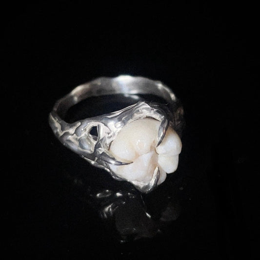 Anillo MOLAR