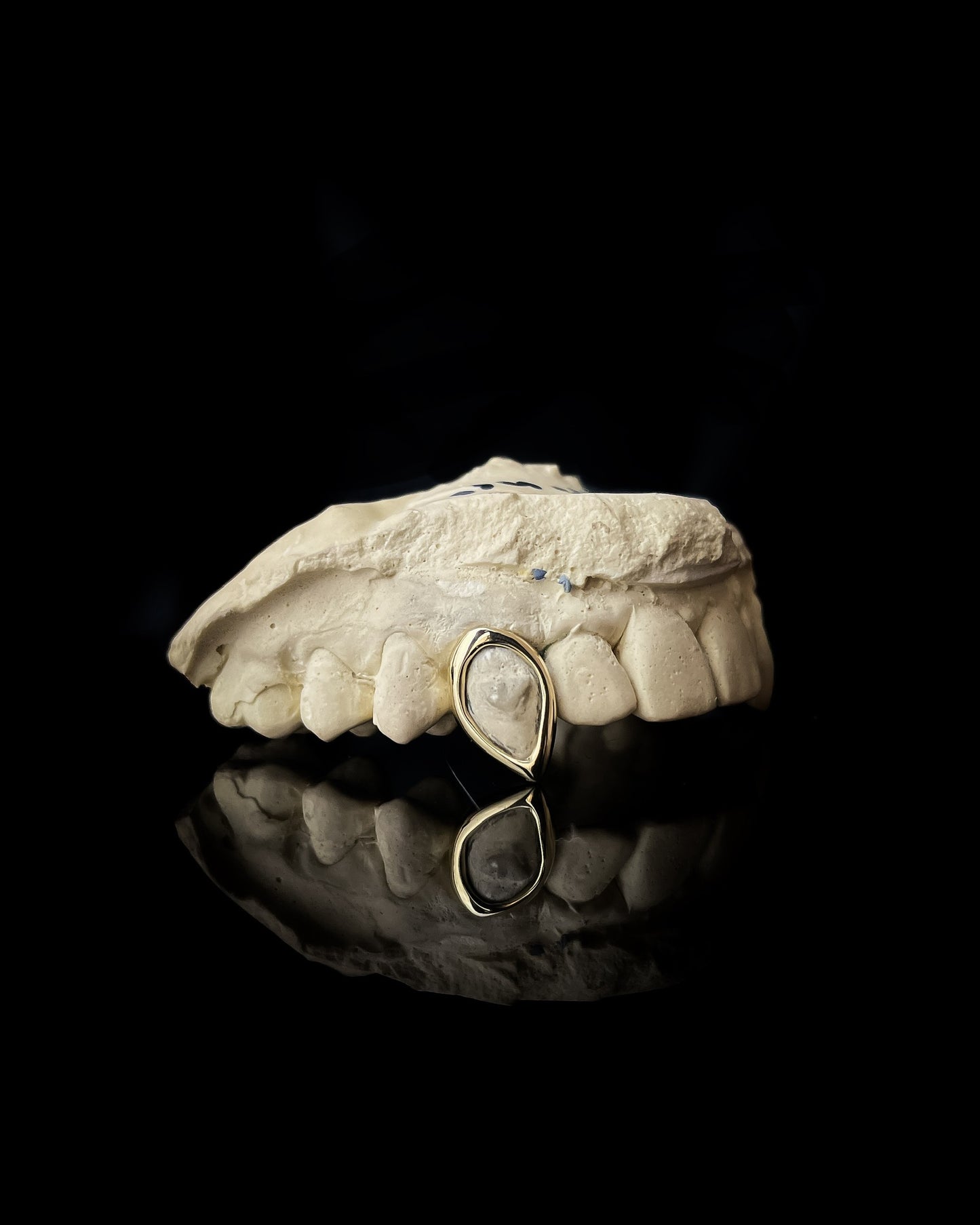 Grillz y carillas