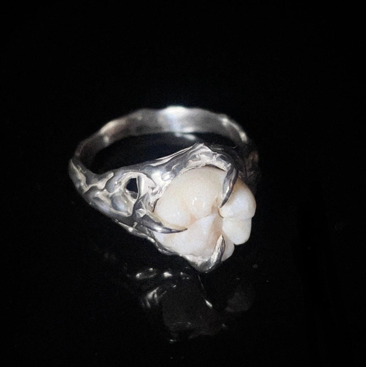Anillo MOLAR