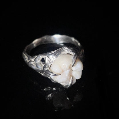 Anillo MOLAR