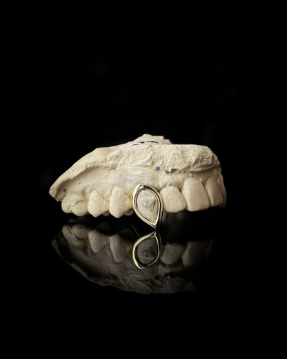 Grillz y carillas